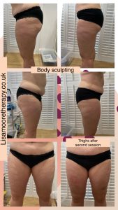 Body Sculpting Before and After