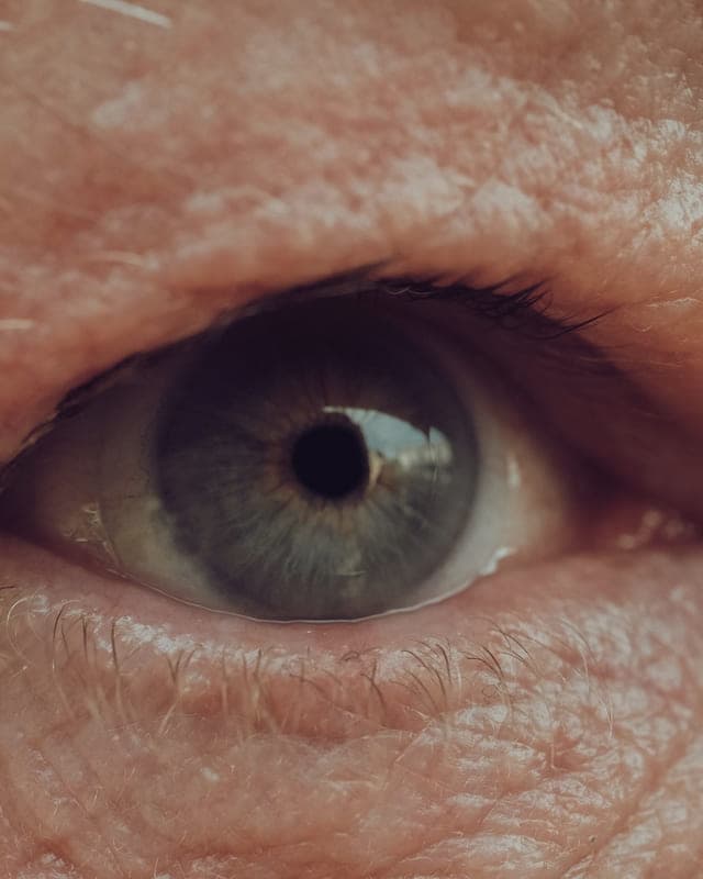 Close-up of an eye with fine lines around it