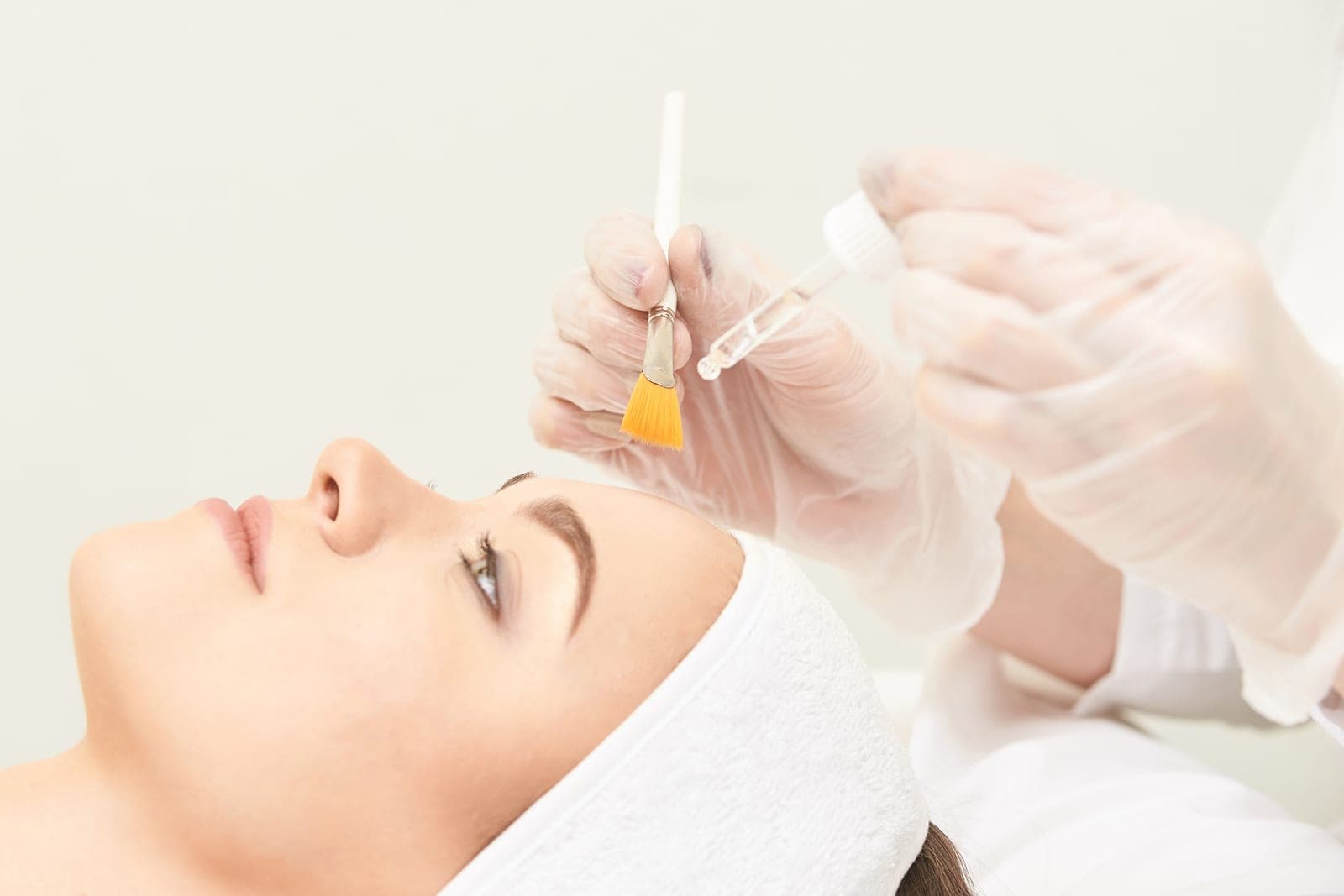 Chemical Peels